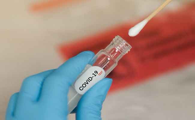 تسجيل ندرة مرتقبة في كواشف تحاليل كورونا