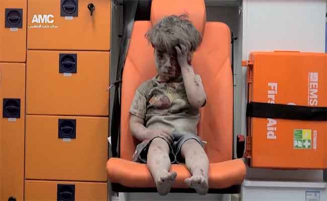 روسيا : لسنا سبب إصابة الطفل 