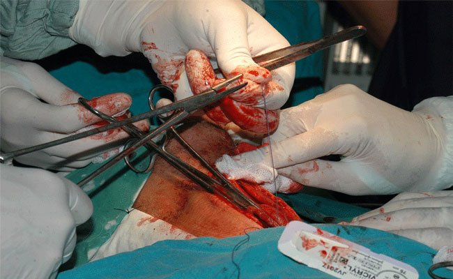 قيام وفد طبي أمريكي بإجراء 20 عملية جراحية دقيقة و مئات الفحوصات للمواطنين بمستشفى تيبازة