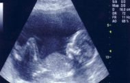 في أي مرحلة من الحمل يظهر الجنين في السونار؟
