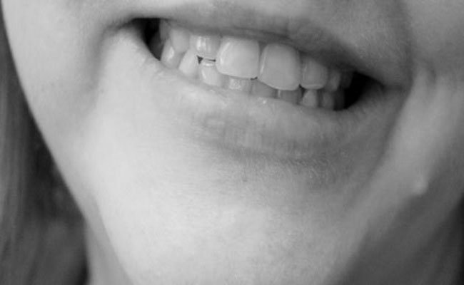 نصائح وعلاجات طبيعية تخلّصك من السواد حول الفم!