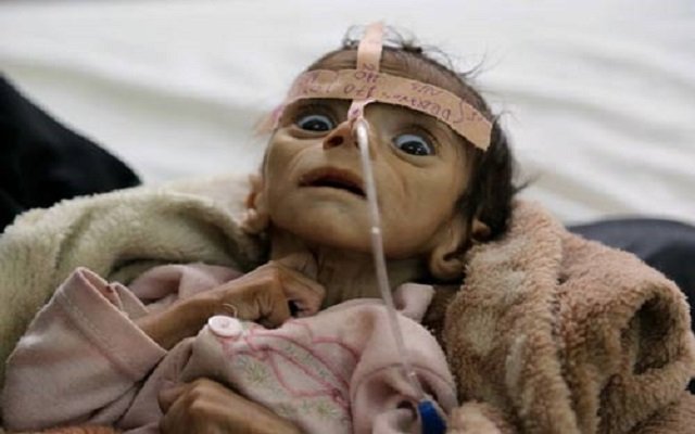 إذا ظلت الموانئ مغلقة سيموت آلاف يوميا باليمن بسبب مجاعة