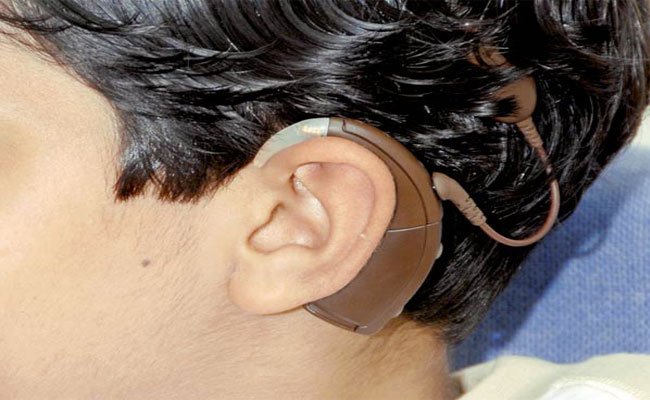توزيع 115 سماعة أذن مجانا لفائدة أشخاص يعانون من  إعاقة في السمع بولاية غرداية