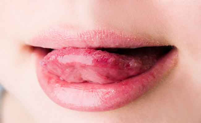 الى مرضى السكري... مشاكل الفم قد تصيبكم في أي لحظة وهذه طرق الوقاية منها!