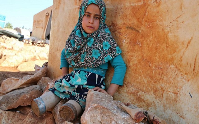 صورة لطفلة سورية وهي تعوض ساقيها المبتورتين بعلب معدنية تشعل صحف العالم