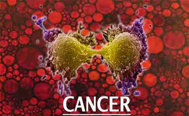 تجويع الخلايا السرطانية أمر ممكن للتغّلب على هذا المرض الخبيث!