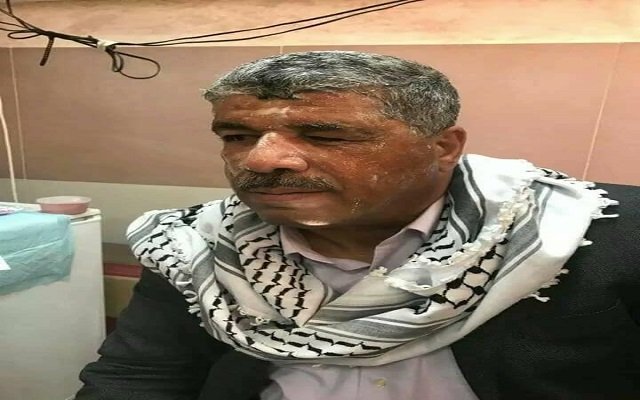 إصابة وزير فلسطيني برصاص الجيش الإسرائيلي غرب رام الله