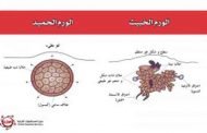 هل تعرفون الفروقات المهمّة التي تميّز الورم الحميد عن الخبيث؟