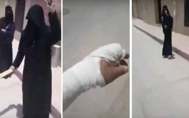 سعودية تكسر يد والدها والنشطاء يتضامنون معها !!!!