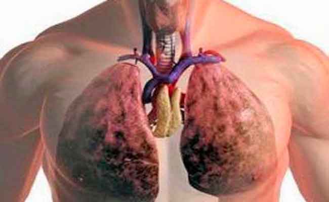 كيف يؤثر التدخين على الجهاز الهضمي؟