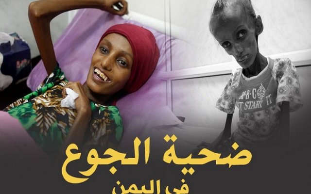 نذالة الحوثيون يسرقون الطعام من أفواه الجائعين