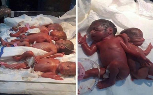 رغم الأزمات ولادة 7 توائم بصحة جيدة في العراق