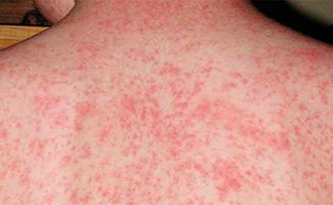 البوحمرون يحصد أرواح 4 أشخاص بباتنة