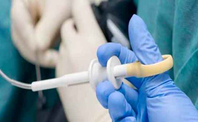 ما هي الأسباب التي تستدعي إجراء تنظير المعدة؟