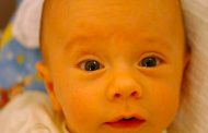 7 أسباب لاصفرار الجلد عند الرضيع...