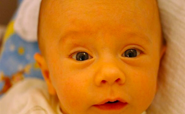 7 أسباب لاصفرار الجلد عند الرضيع...