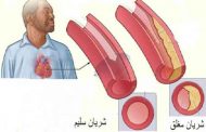 تصلب الشرايين الوقاية أفضل من العلاج...