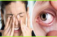 6 أسباب شائعة للإصابة بجفاف العين...!