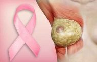 هل يُصيب سرطان الثدي الفتيات غير المتزوّجات...؟