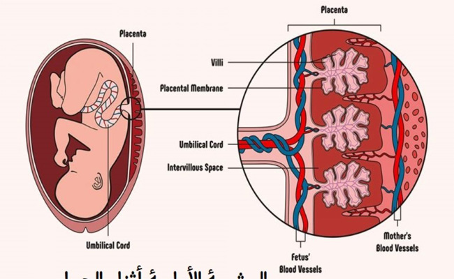 ما هي المضاعفات المحتملة للمشيمة خلال الحمل…؟
