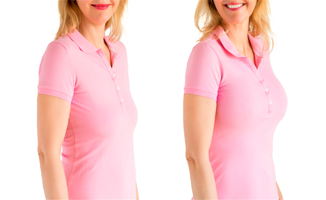 متى يجب الخضوع إلى عملية شد الثدي…؟