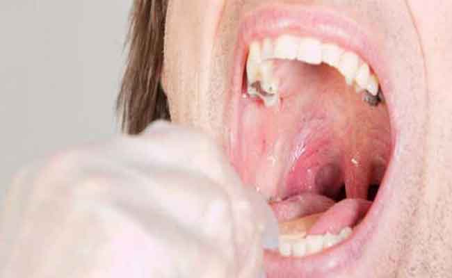 لماذا يمكن أن يستمرّ ألم الحلق طويلاً…؟