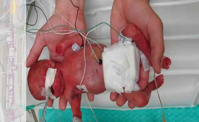 كيف يكون وضع الجنين بعد الولادة في الشهر السابع من الحمل…؟