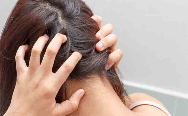 كيف يمكن الحفاظ على فروة رأس صحيّة…؟