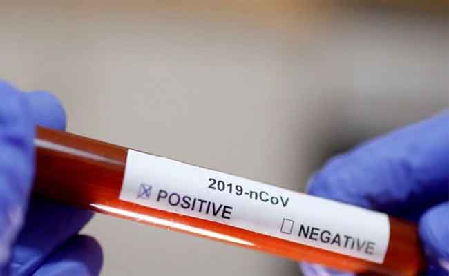 الحالة الوبائية بالجزائر اليوم : 186 إصابة مؤكدة و 7 وفيات و 60 حالة تماثلت للشفاء