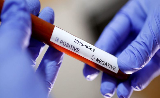 حصيلة كورونا خلال الـ24 ساعة الأخيرة : 165 حالة إصابة و 7 حالات وفاة و 222 حالة شفاء