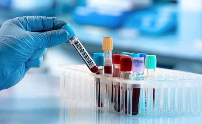 ارتفاع عدد المصابين بكورونا إلى 4838 بعد تسجيل 190 إصابة جديدة مؤكدة