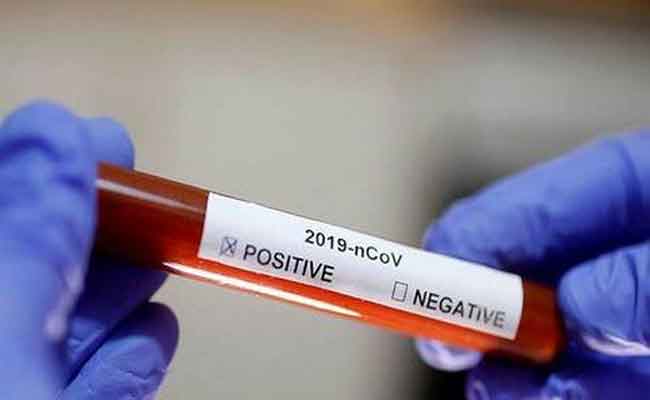 ارتفاع عدد المصابين بكورونا في الجزائر إلى 7918 حالة و  582 حالة وفاة و 4256 حالة شفاء