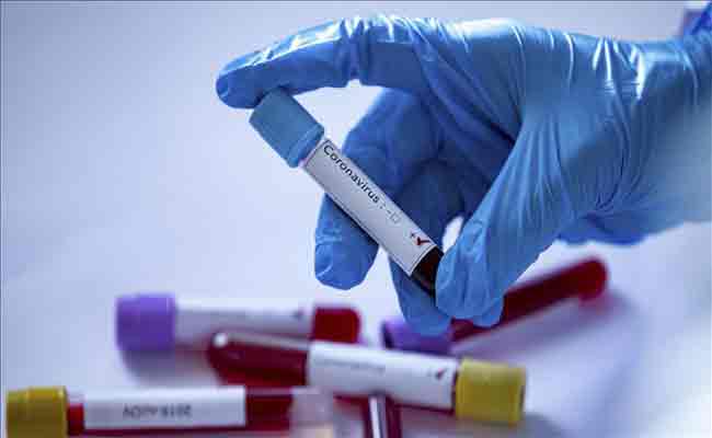 كوفيد 19 :  182 إصابة و 7 وفيات و 118 حالة شفاء خلال الـ24 ساعة الأخيرة