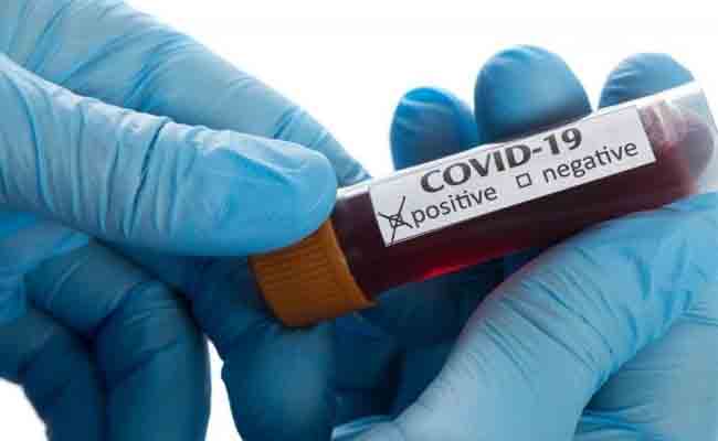 الجزائر تسجل 165 حالة إصابة مؤكدة بفيروس كورونا و 8 وفيات خلال الـ24 ساعة الأخيرة