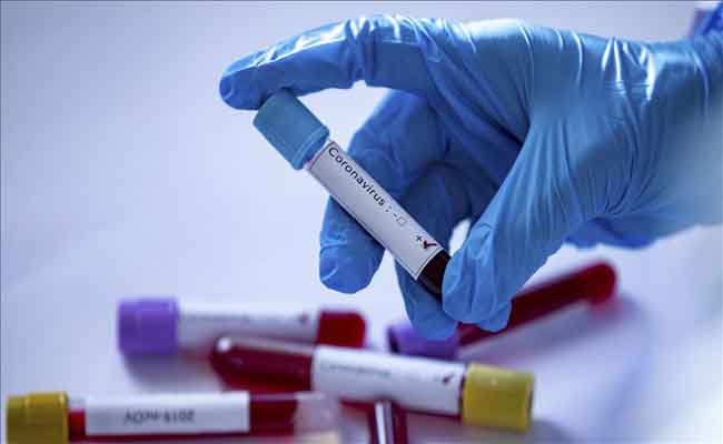 تسجيل 197 حالة إصابة مؤكدة بكورونا و 9 وفيات و شفاء 169 مريضا خلال الـ24 ساعة الأخيرة