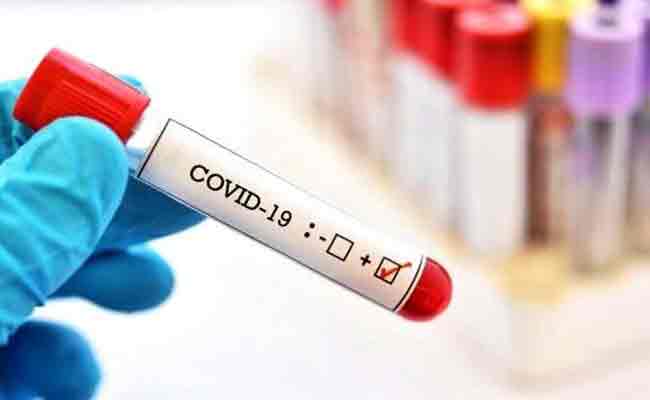 تسجيل 187 إصابة مؤكدة بكورونا و 113 حالة شفاء و 7 وفيات خلال الـ24 ساعة الأخيرة