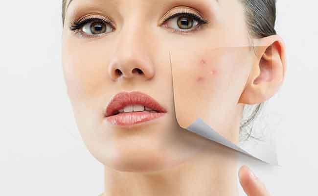 بشرتك ناشفة وفيها حبوب مزعجة؟ اليك الحلول…