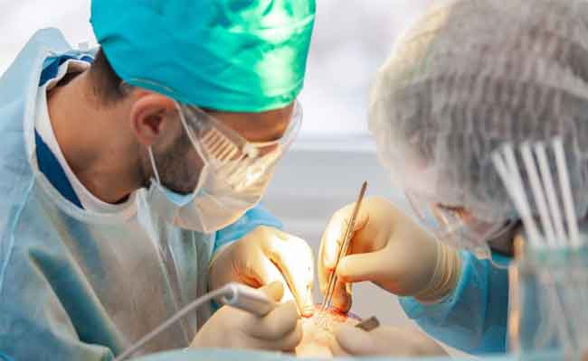 كلّ ما تريدين معرفته عن عملية زراعة الأرداف…