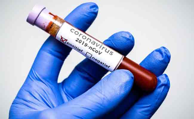 الجزائر تتجاوز عتبة الـ25 ألف مصاب بكورونا