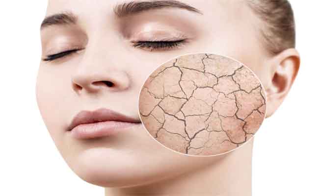 بشرتك جافة… هذه هي طريقة العناية بها واختيار الكريم المناسب لها…