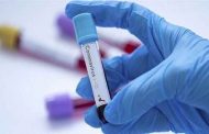 الجزائر تسجل 593 إصابة جديدة بفيروس كورونا و 5 وفيات و 323 حالة شفاء