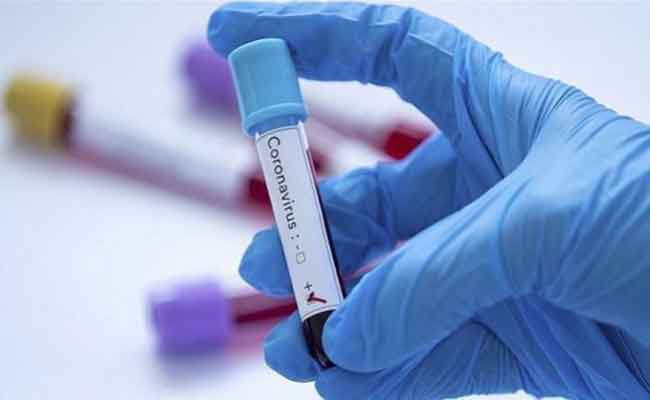 الجزائر تسجل 593 إصابة جديدة بفيروس كورونا و 5 وفيات و 323 حالة شفاء