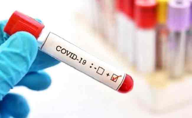 الجزائر تسجل 594 حالة إصابة بكورونا و 337 حالة شفاء و 11 وفاة خلال الـ24 ساعة الاخيرة