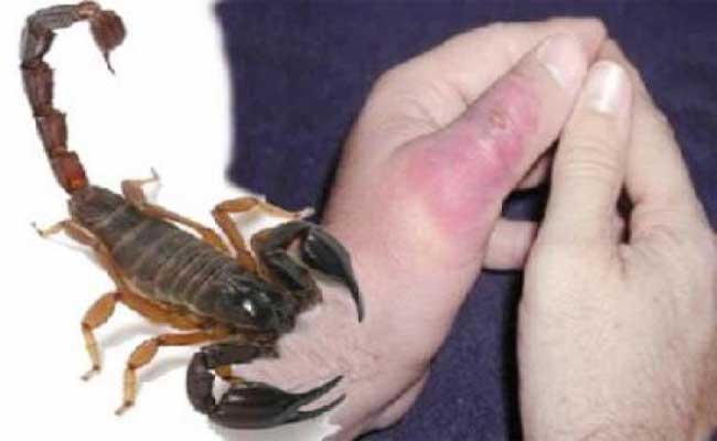 تسجيل انخفاض في عدد المصابين بلسعات العقارب بولاية ورڨلة