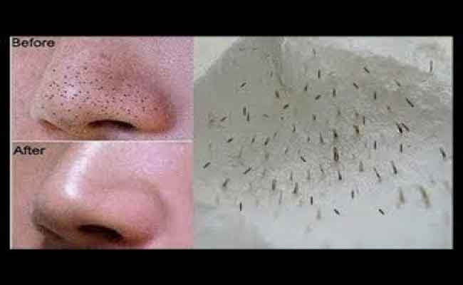 طرق فعّالة جداً تخلصكم من الرؤوس السوداء نهائياً!…