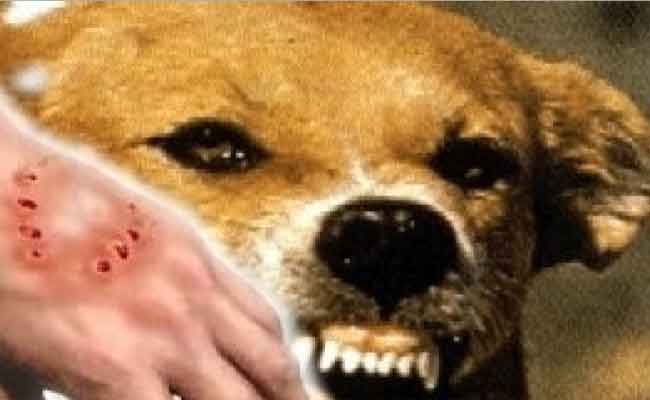 الجزائر تسجل 900 حالة إصابة بداء الكلب و 15 حالة وفاة