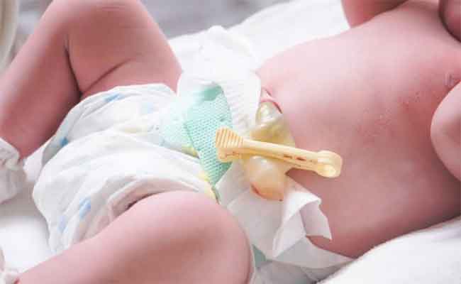 خطوات اساسية للعناية بالطفل الرضيع بعد الولادة…