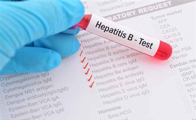 هل الكبد الوبائي مُعدٍ؟ اكتشفوا الجواب الدقيق عن هذا التساؤل…