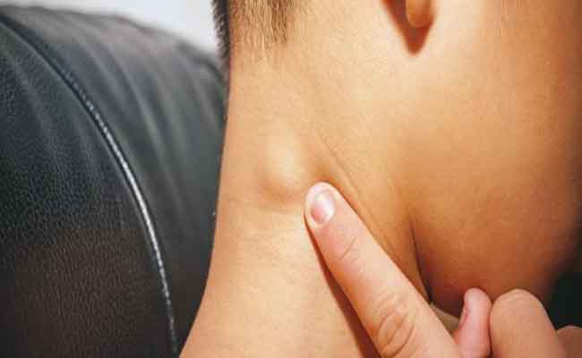 ما الذي يسبب تضخّم الغدد اللمفاوية في الجسم؟…