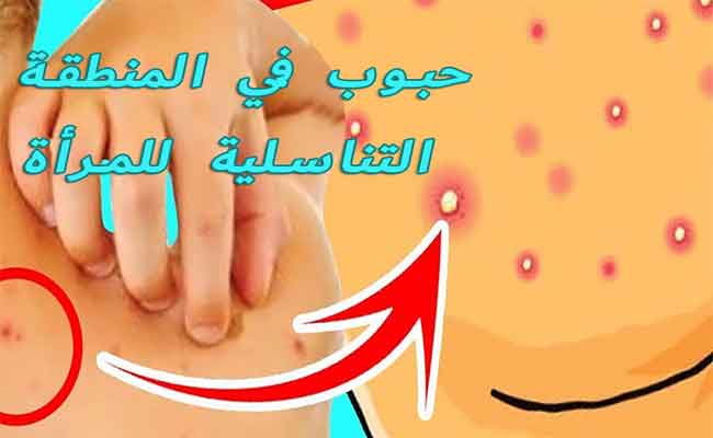 هذه الأسباب تؤدي إلى ظهور حبوب في المهبل!…